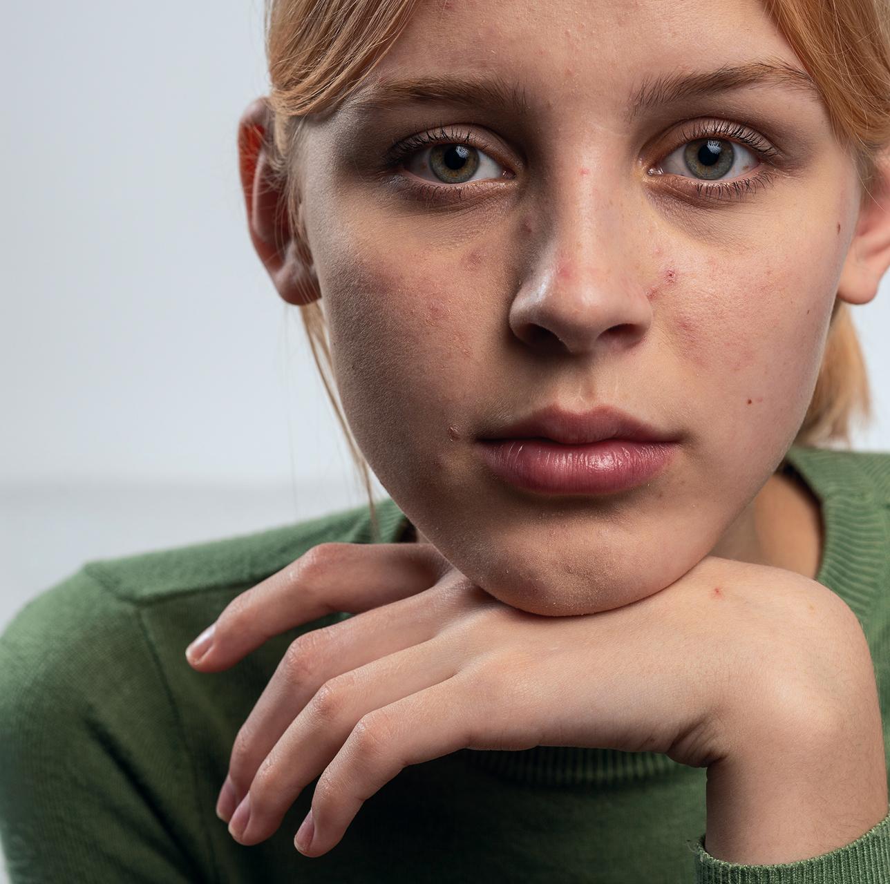 Person with symptoms